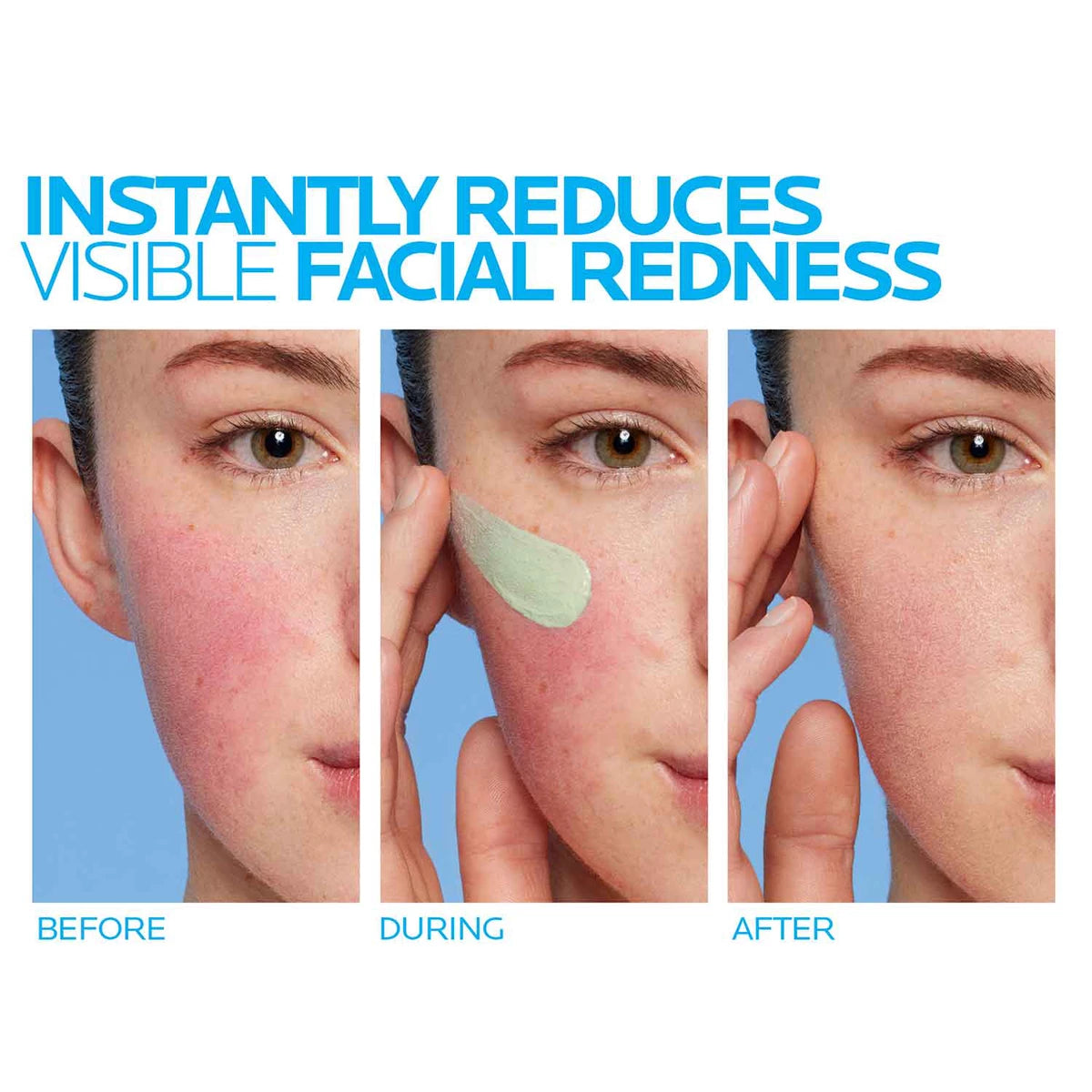 Toleriane_Rosaliac-AR-before-after