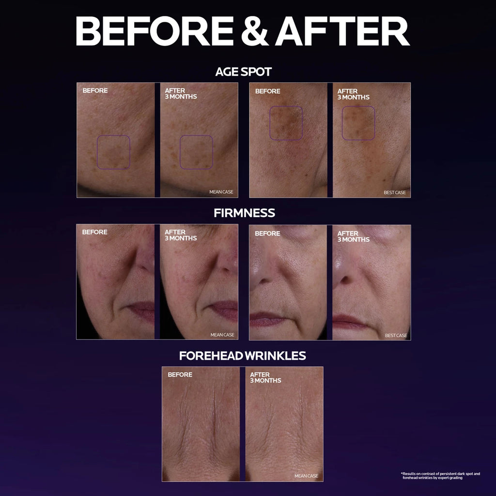 Mela B3 Double Dose Discoloration Treatment with Melasyl™